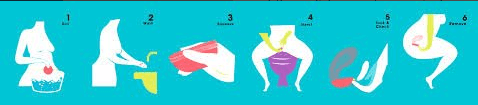 Nixit - Disque menstruel - tagrandmereapprouve